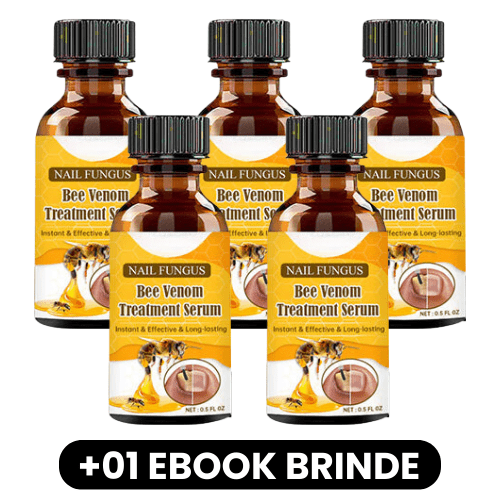 NAIL FUNGUS - Sérum para Remoção de Fungos nas Unhas - Mania das CoisasNAIL FUNGUS - Sérum para Remoção de Fungos nas UnhasMania das Coisas