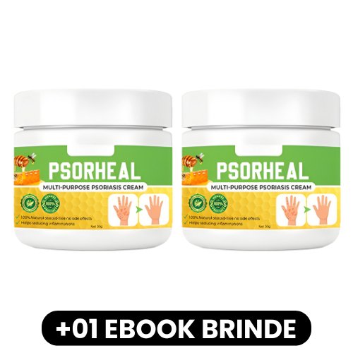 PsorHeal - Creme Multiuso para Psoríase - Mania das CoisasPsorHeal - Creme Multiuso para PsoríaseMania das Coisas
